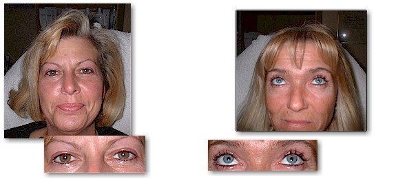 Permanent Make up Lidstriche bzw. Eyeliner